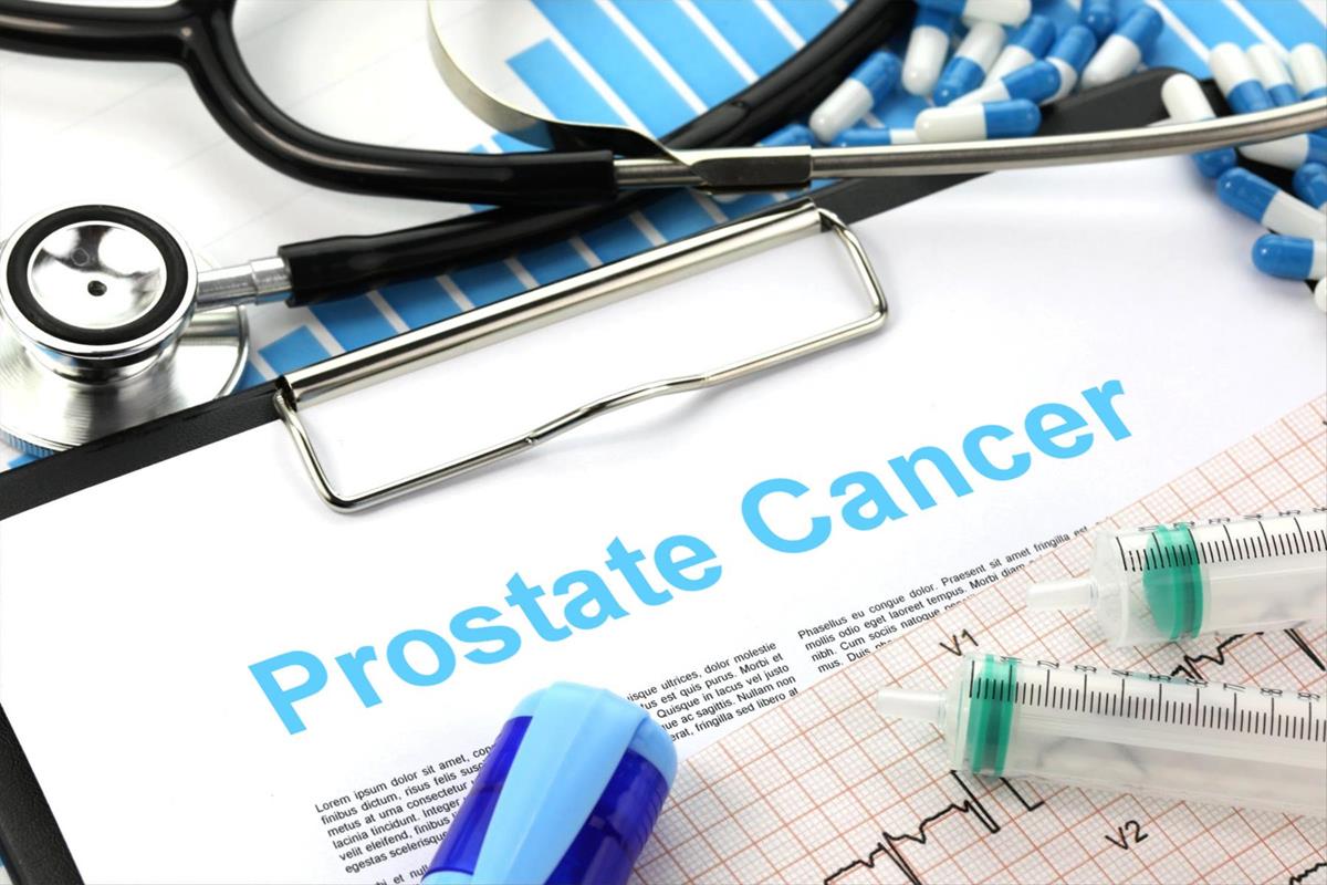 Choosing the Right Prostate Cancer Doctor for Your Treatment Plan