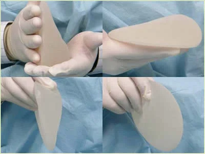 Fat Grafting: The Natural Alternative for Breast Augmentation