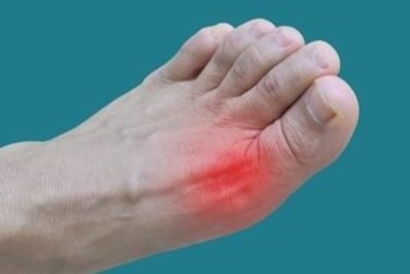 Ingrown Toenails and Diabetes: A Guide to Protecting Foot Health