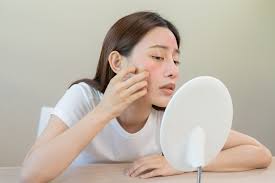Skin Care Tips for Oily Skin in Hot Weather