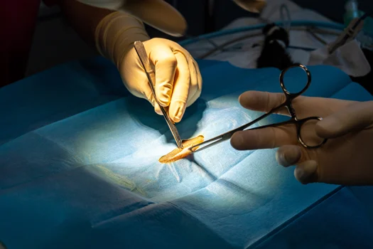 The Role of Wound Care Specialists in Post-Surgical Healing