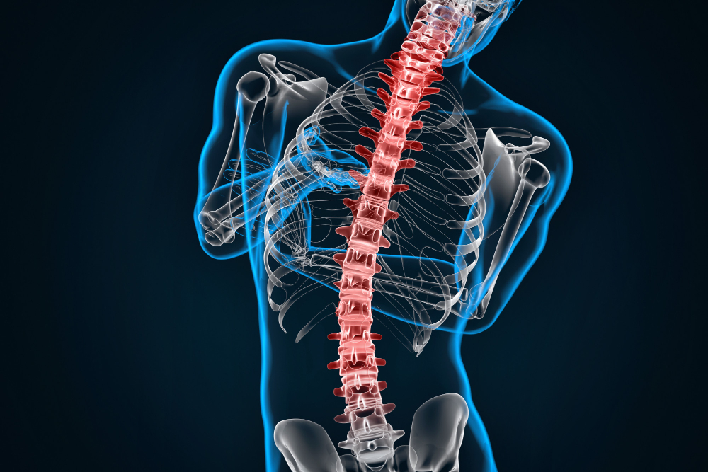 The Role of a Spine Doctor in Treating Spinal Stenosis