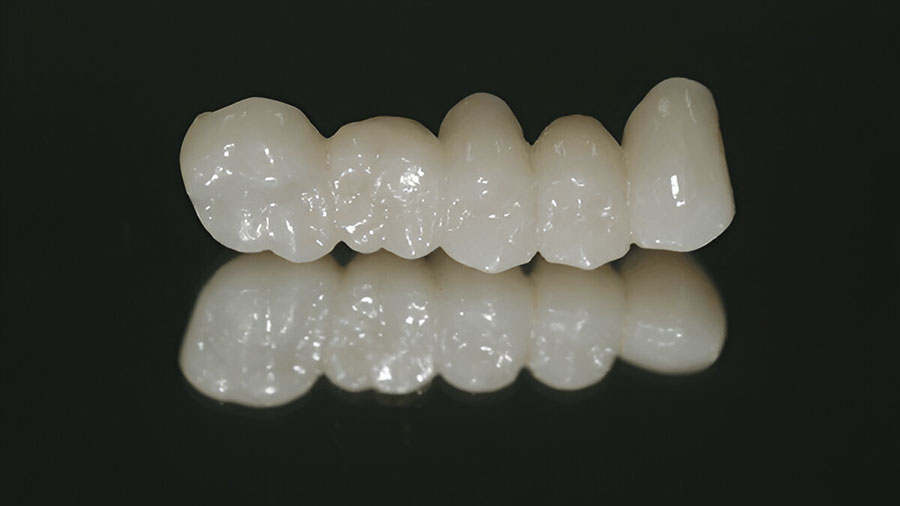 Zirconia Crown Price in India: The Ultimate Choice for a Reliable Smile