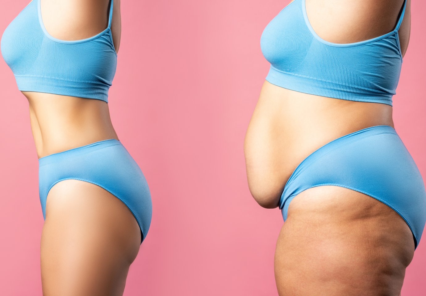 Benefits of Gastric Sleeve Surgery for Obesity Management
