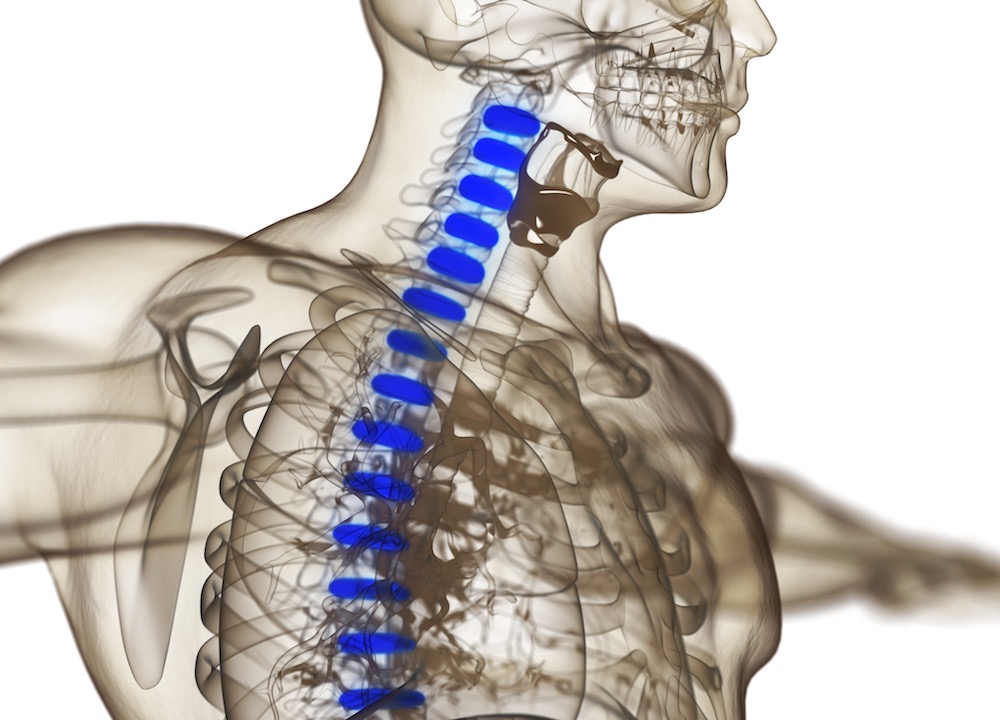 Can I Have a Herniated Disc in My Neck?