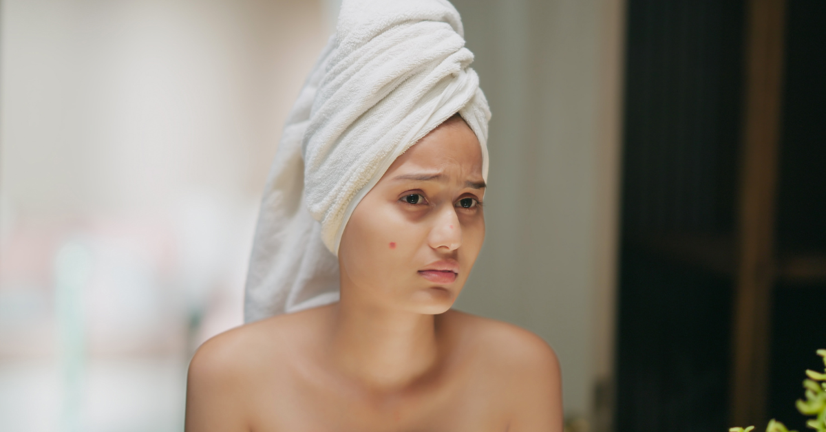 Cosmetic Dermatology Procedures for Acne
