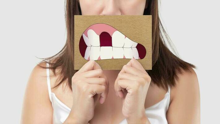 FAQs About Traumatic Dental Injuries