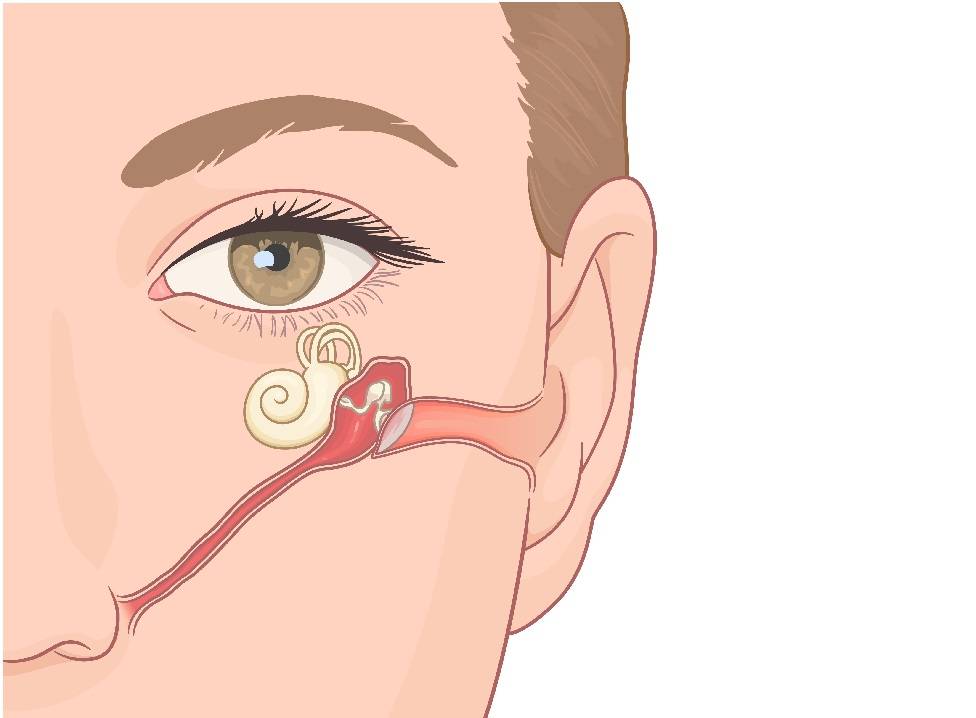 How Balloon Sinuplasty Can Provide Relief for Allergic Rhinitis