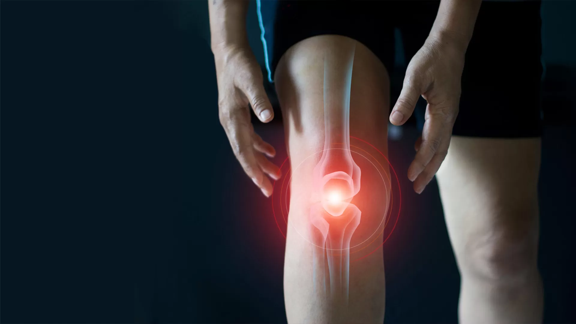 How Meniscectomy Can Impact Your Long-Term Joint Health