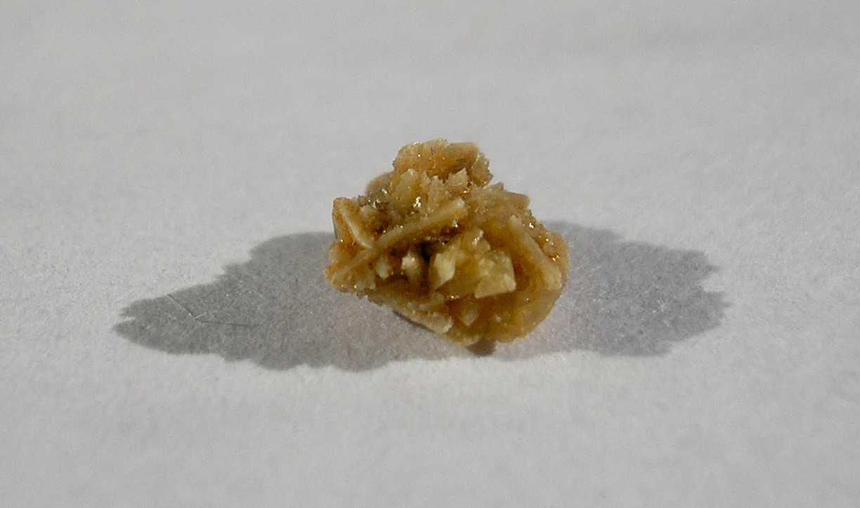 How To Help Prevent Kidney Stones