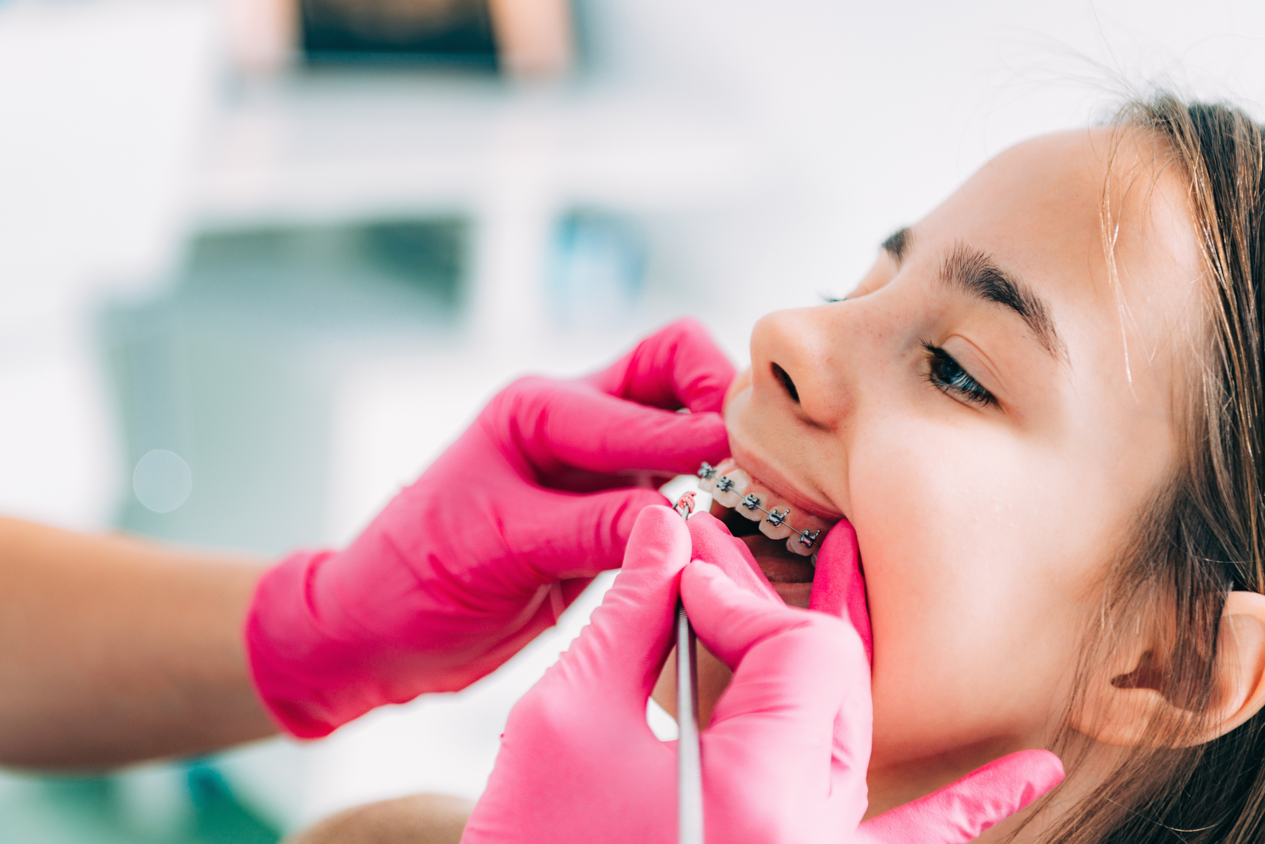 Impacted Teeth in Adolescents: What Parents Should Know