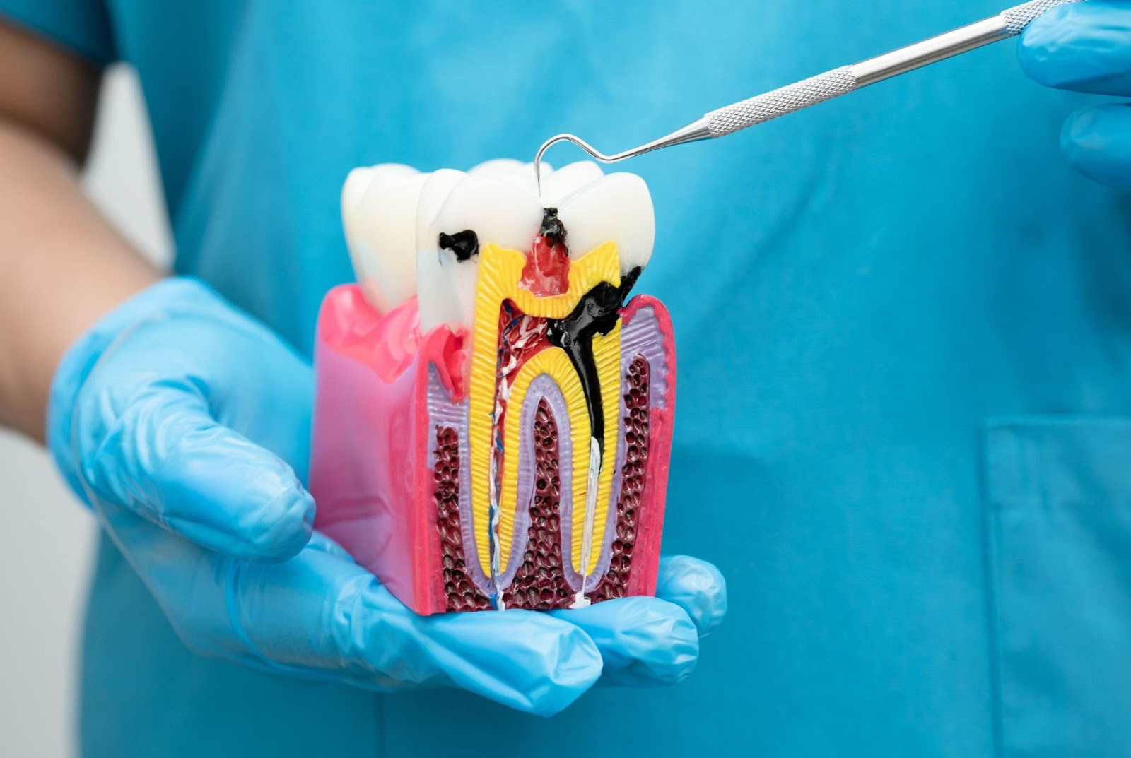 What To Expect During a Root Canal Procedure