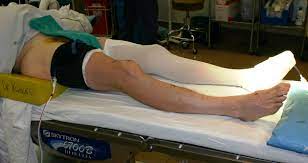 Steps for a Successful Recovery After Knee Replacement