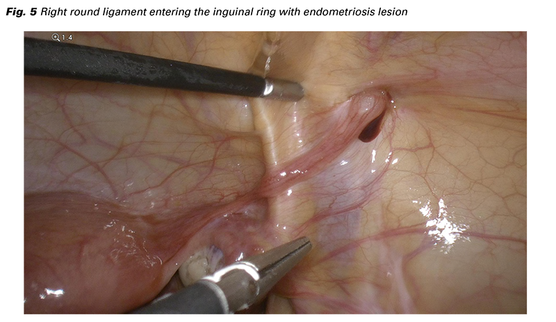 Exploring the Common Types of Cysts and Their Causes